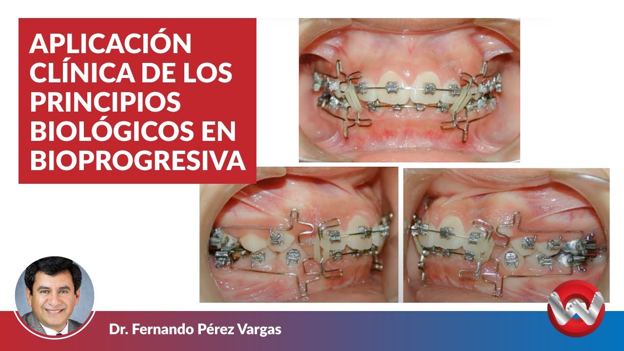 Aplicación clínica de los principios biológicos en Bioprogresiva