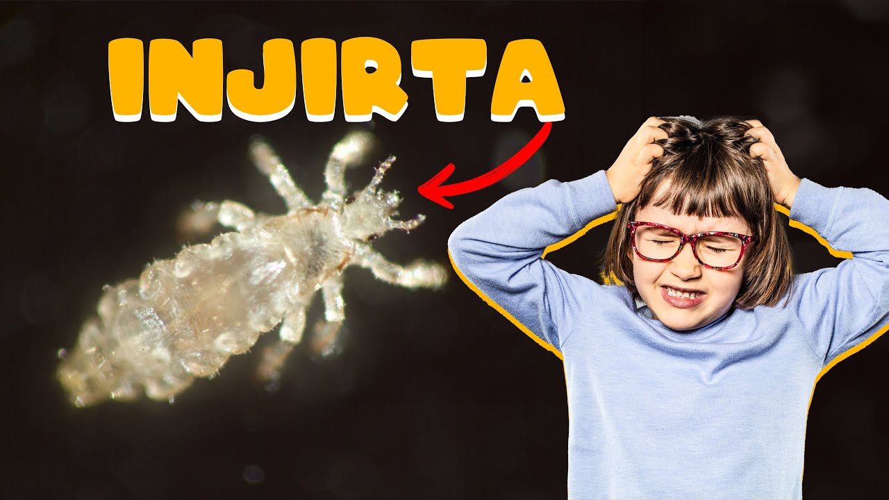Injirta Sida Ay Ku Gasho Ragga iyo Dumarka.@jiilmedia