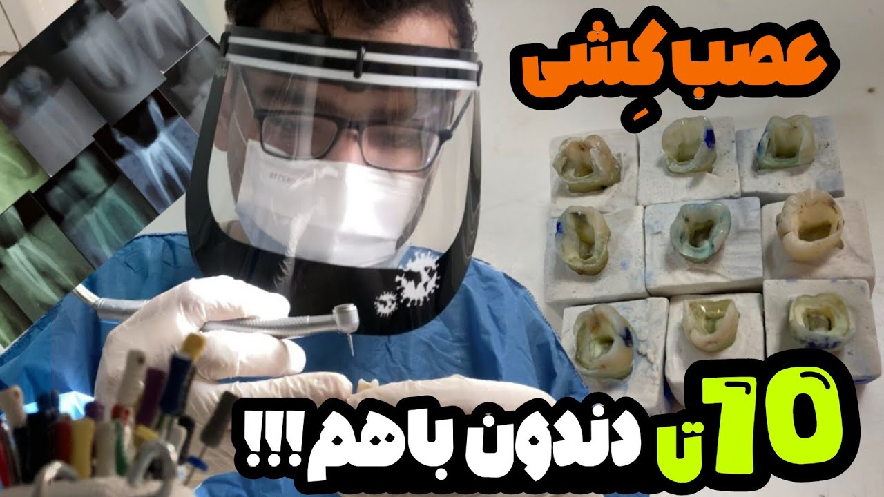 قدم به قدم عصب کشی یک بار برای همیشه !