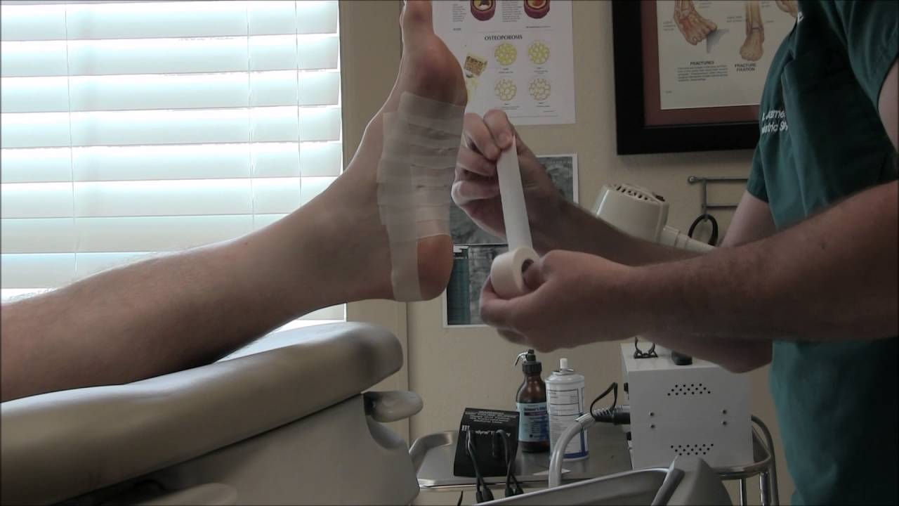 Athletic Taping for Plantar Fascia Pain