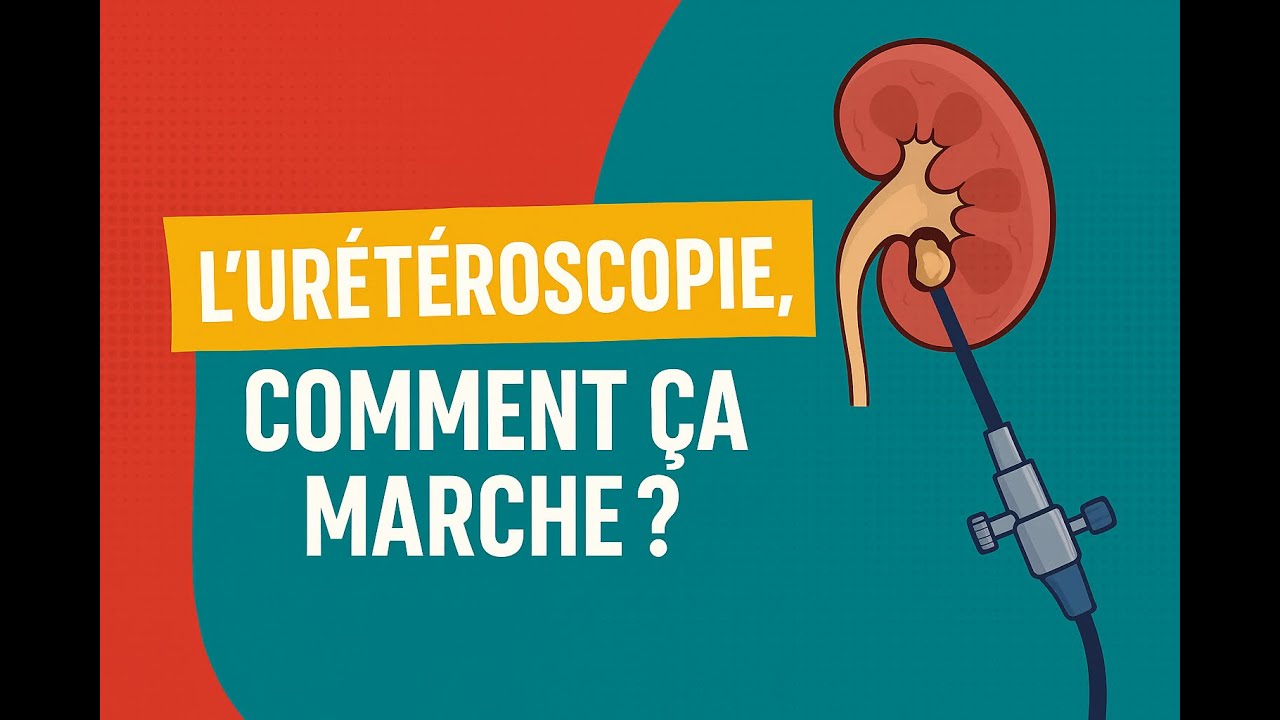 Urétéroscopie : comment on enlève les calculs rénaux, sans incision