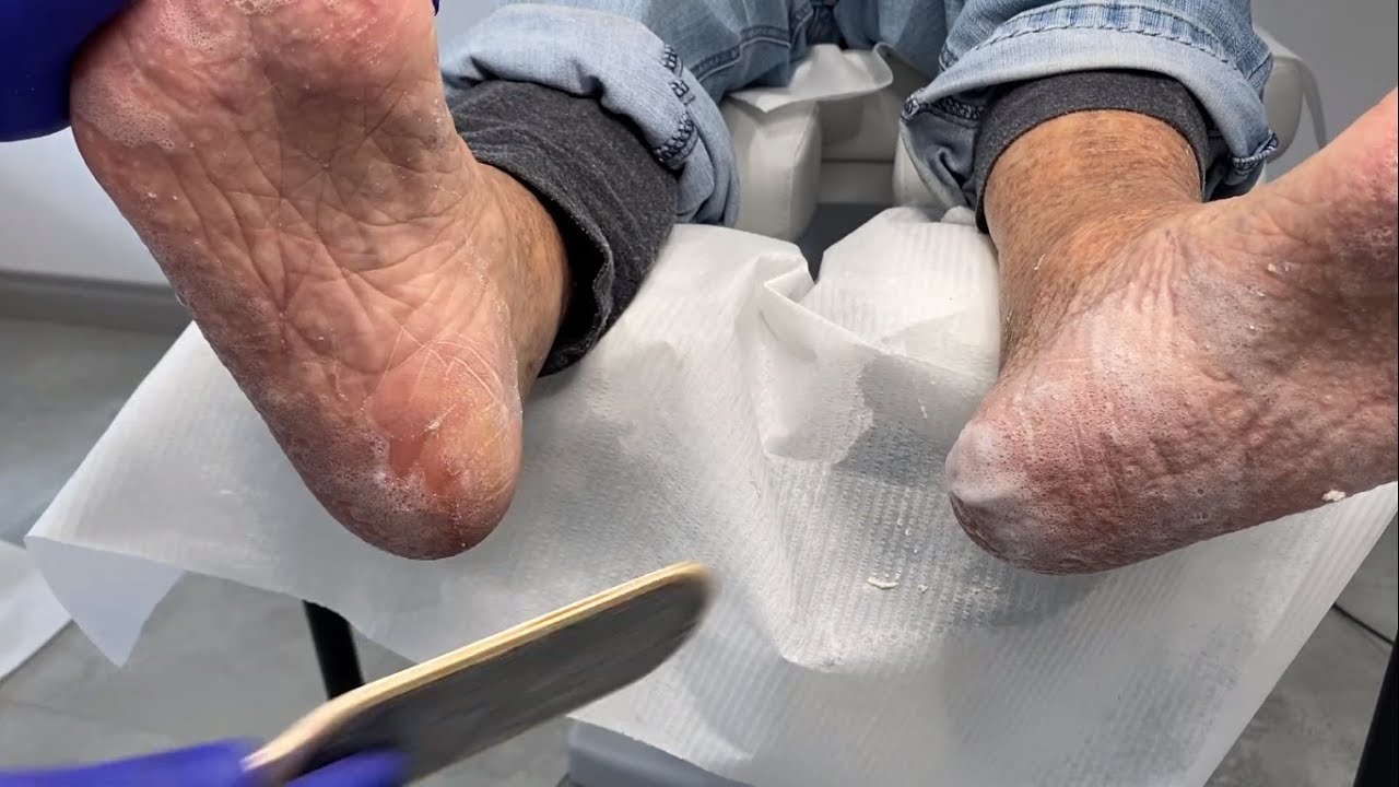 Made in Podoland - ZESTAW DO DOMOWEGO PEDICURE /SURVIVAL KIT FOR DIY - PEDICURE (SUB: PL/ENG/RU)