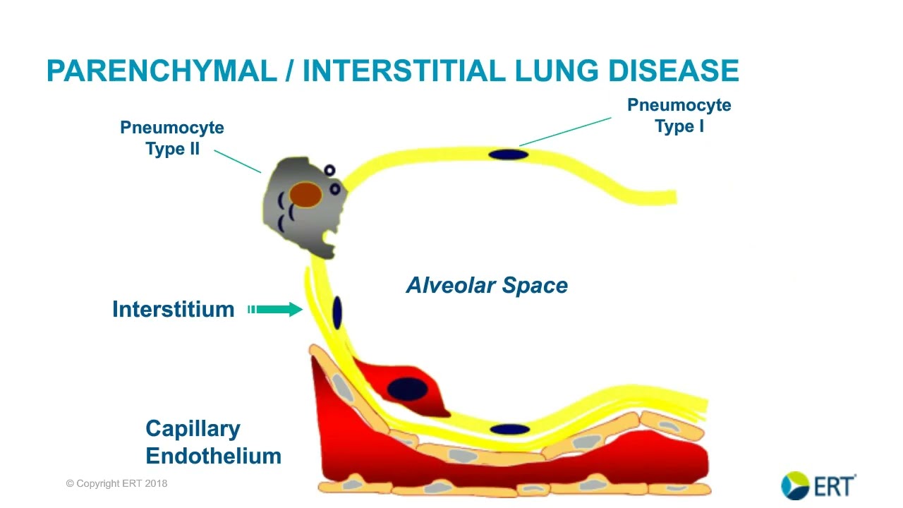 Lung Safety and Disease Progression in Non-Respiratory Trials