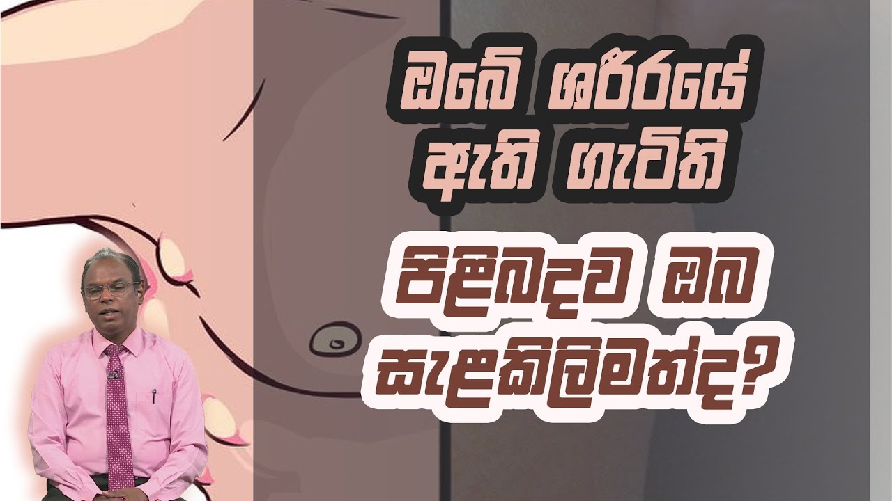 ඔබේ ශරීරයේ ඇති ගැටිති පිළිබදව ඔබ සැළකිලිමත්ද? | Piyum Vila | 30 - 12 - 2020 |Siyatha TV