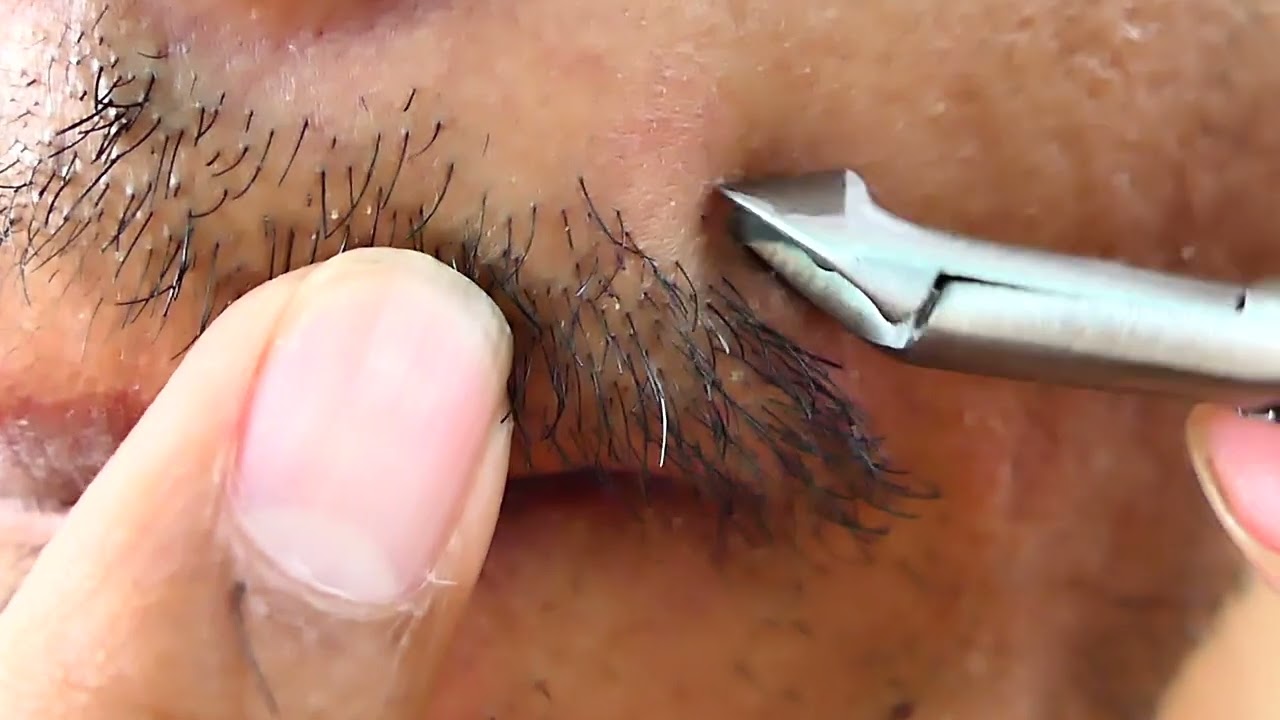 The Art of Beard Plucking 