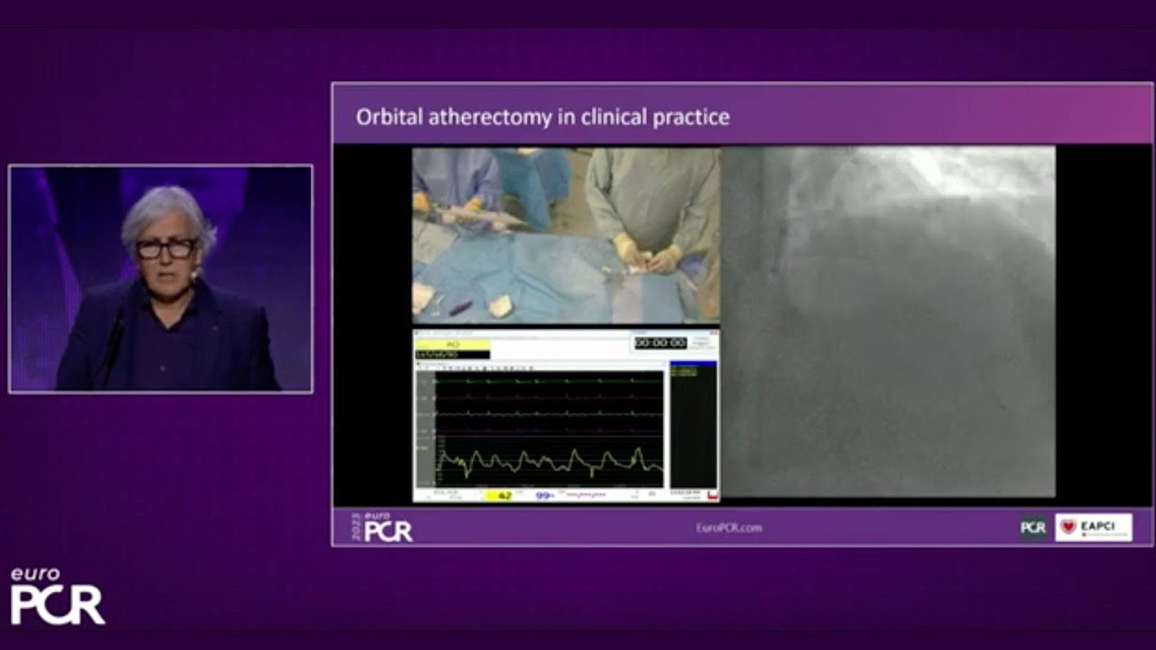 Orbital atherectomy, a versatile tool to manage complex vessel calcification scenarios - EuroPCR 23