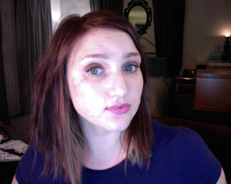 All Done Dancing - Dating As An Amputee