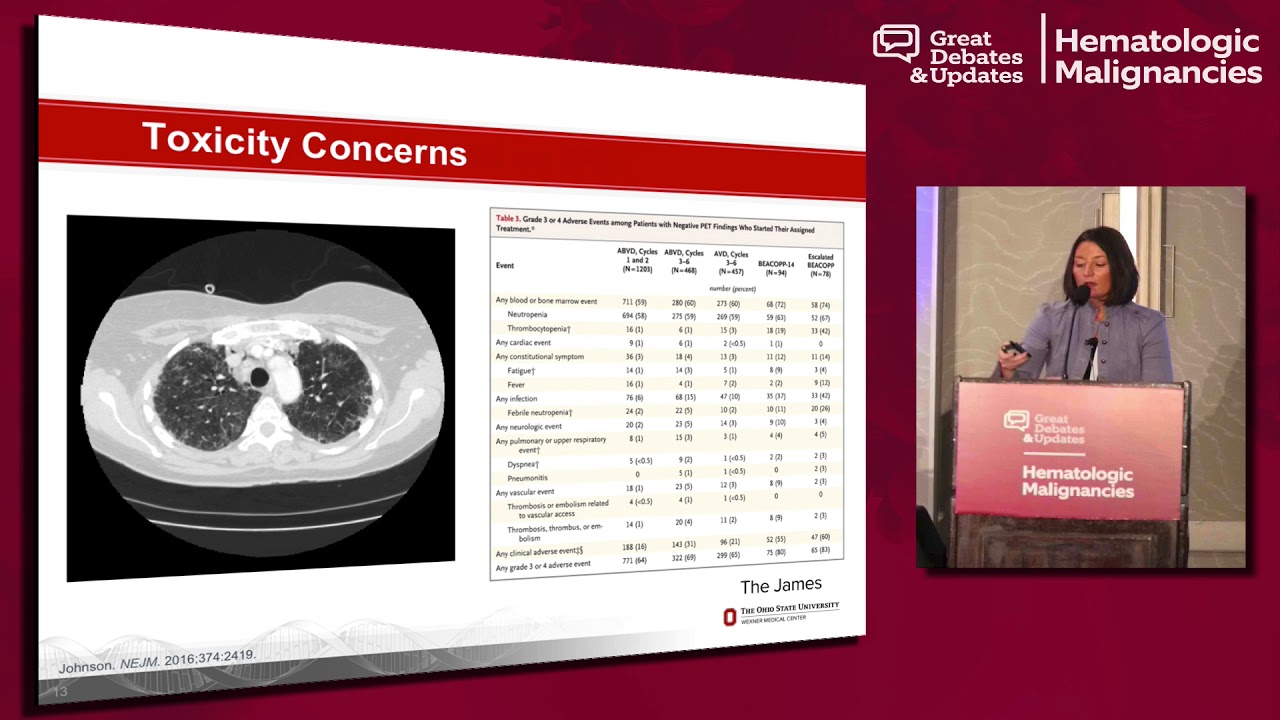 Initial Therapy of Advanced Stage Hodgkin Lymphoma: When to Use ABVD, A(BV)VD, and BEACOPP