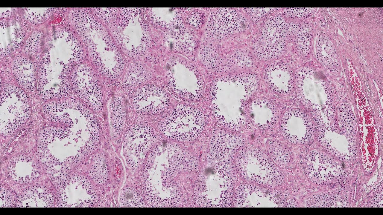 testis