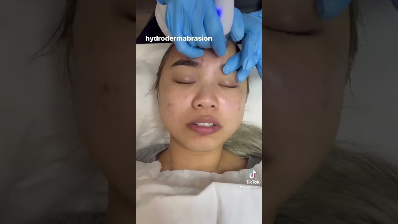 what a PAINFUL facial 😫