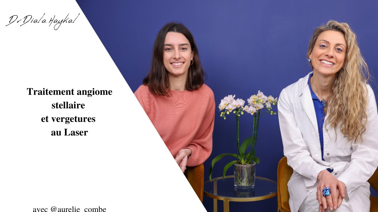 Traitement Angiome stellaire et Vergetures au  Laser