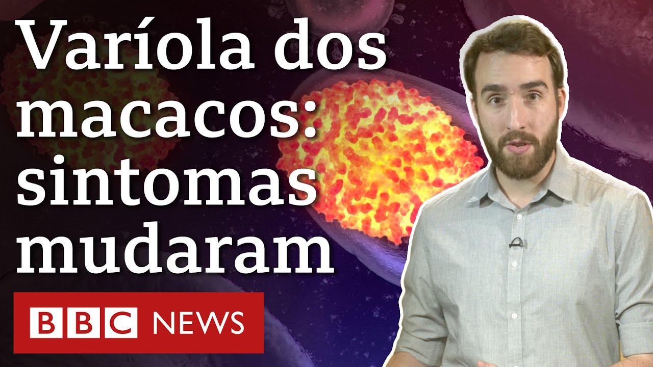 Sintomas da varíola dos macacos mudam e intrigam médicos