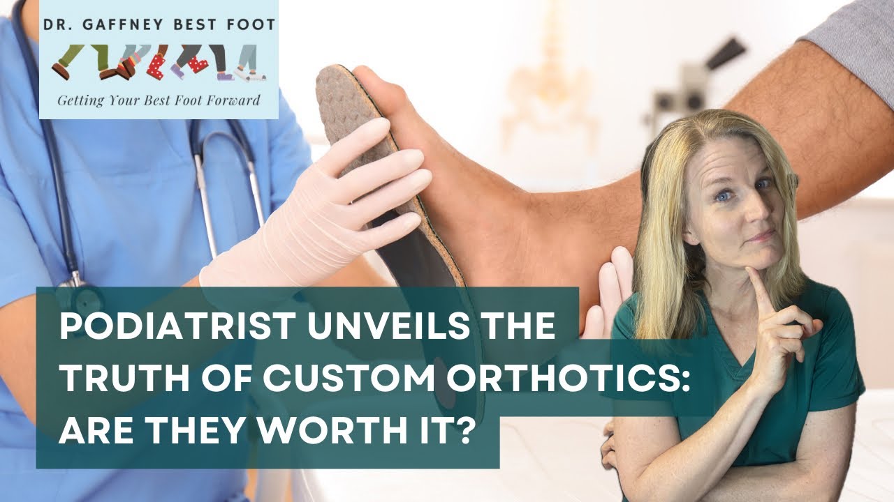 Are custom orthotics worth it?