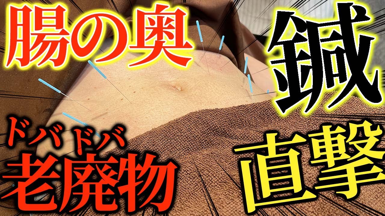 【吸い玉　整体】悶絶お腹痩せ吸い玉、腹筋直撃の鍼でだるだるお腹を引き締める？　これはやばい、痛い。。。