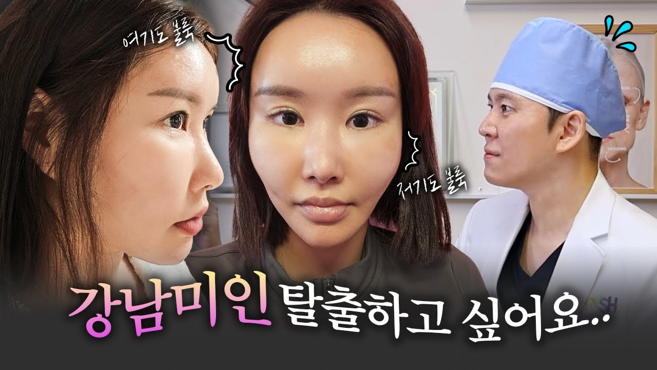 ❣️미세지방흡입 이마복원+얼굴지방흡입+옆광대｜상담편｜사람들이 쳐다보는게 부담스러워요 강남미인 탈출하게 해주세요😭