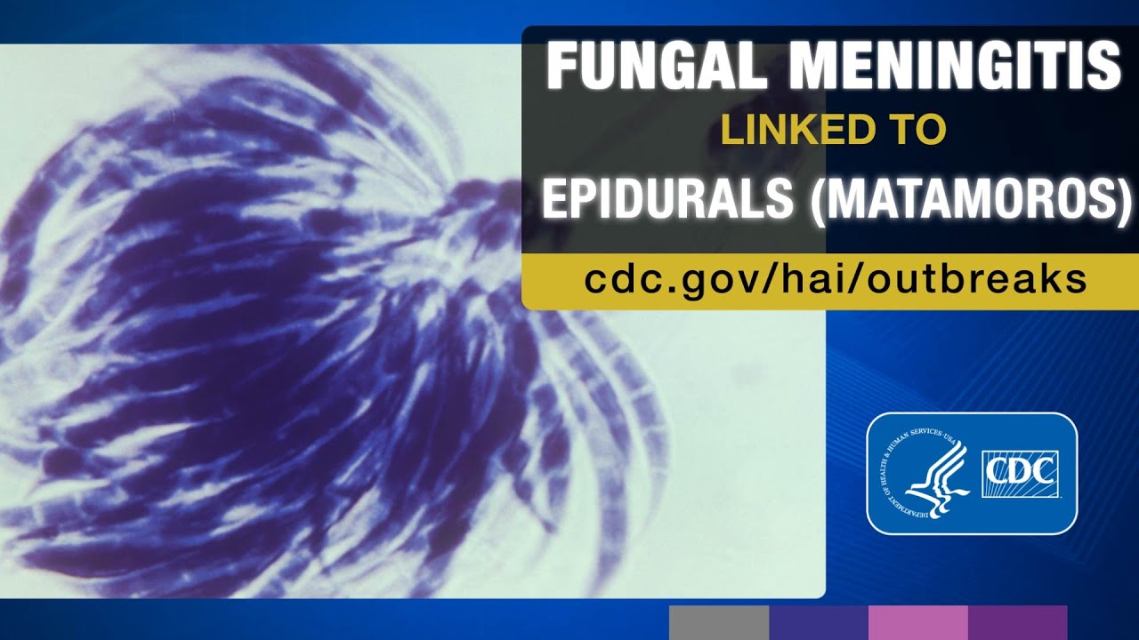 CDC&rsquo;s Tom Chiller on the Outbreak of Fungal Meningitis - H