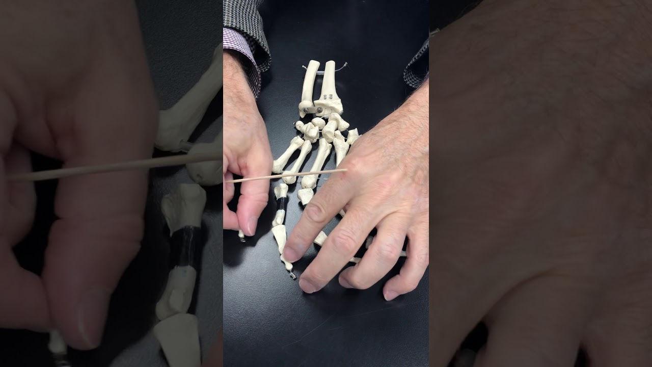 Humerus, Ulnar, Radius and Bones of the Hand with Dr. Masi