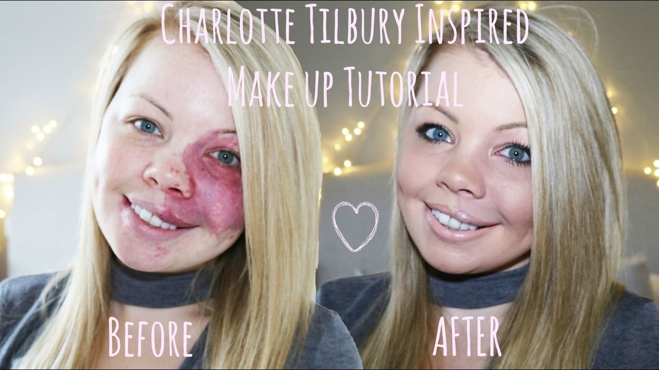 Birthmark Coverage // Charlotte Tilbury Inspired Make Up Tutorial // Amy Elsegood