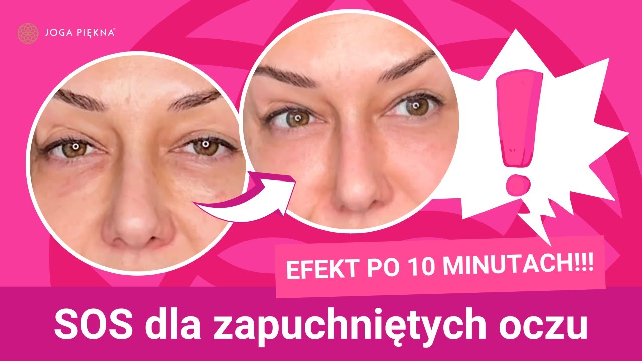 SOS na opuchnięte oczy! Efekt po kilkunastu minutach! I Joga twarzy I Masaż Twarzy