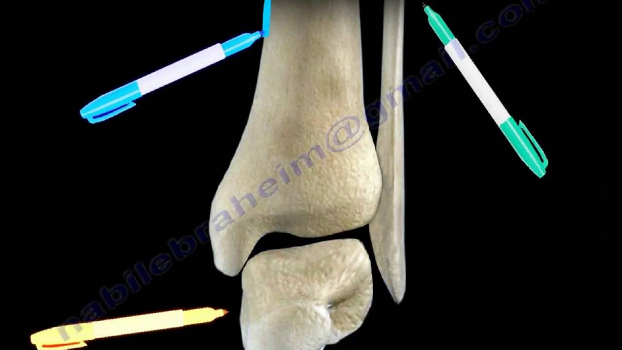 Ankle Fractures and the Syndesmosis - Everything You Need To Know - Dr. Nabil Ebraheim