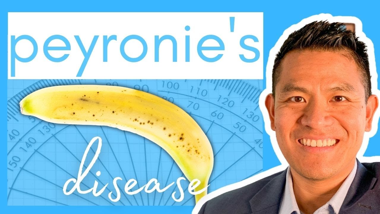 How to Straighten Out a Bent Penis with Peyronie's Disease