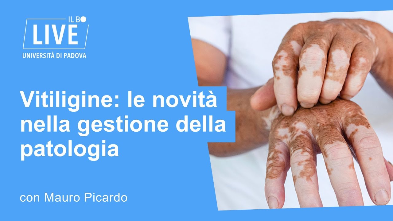 In Salute. Vitiligine, le novità nella gestione della patologia