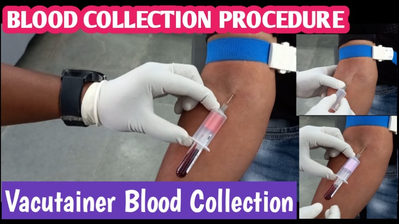 Blood Collection Technique | How to Blood Collection | Vaccutainer Blood Collection Method