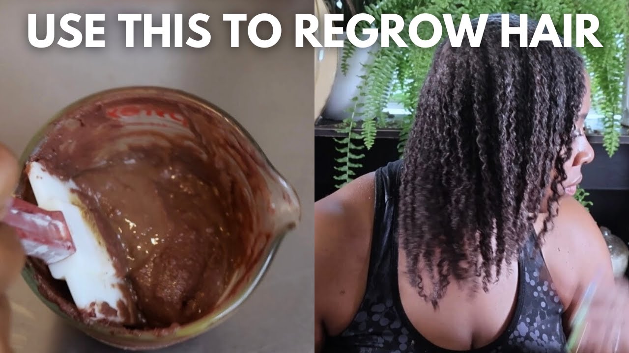 Reduce Scalp Inflammation and Block DHT| Prevent Hair Loss Challenge-Week 9