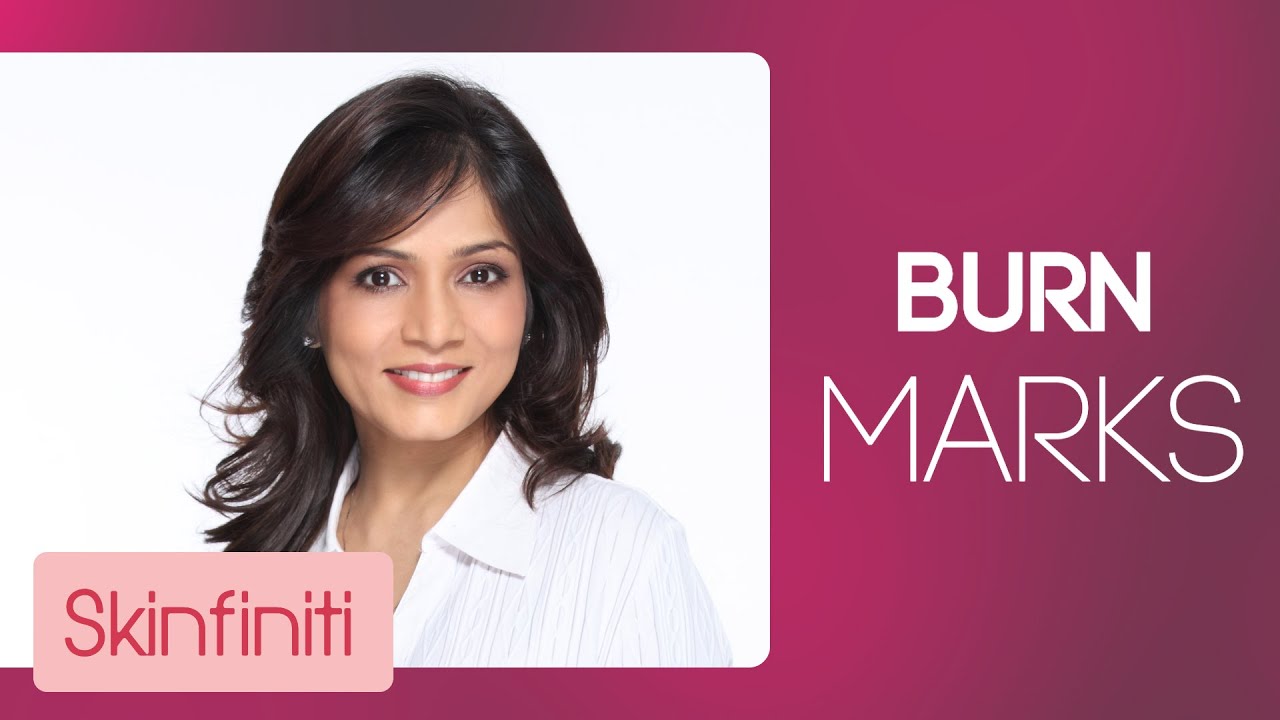 How To Treat Burn Marks || Skincare || Skinfiniti With Dr.Jaishree Sharad