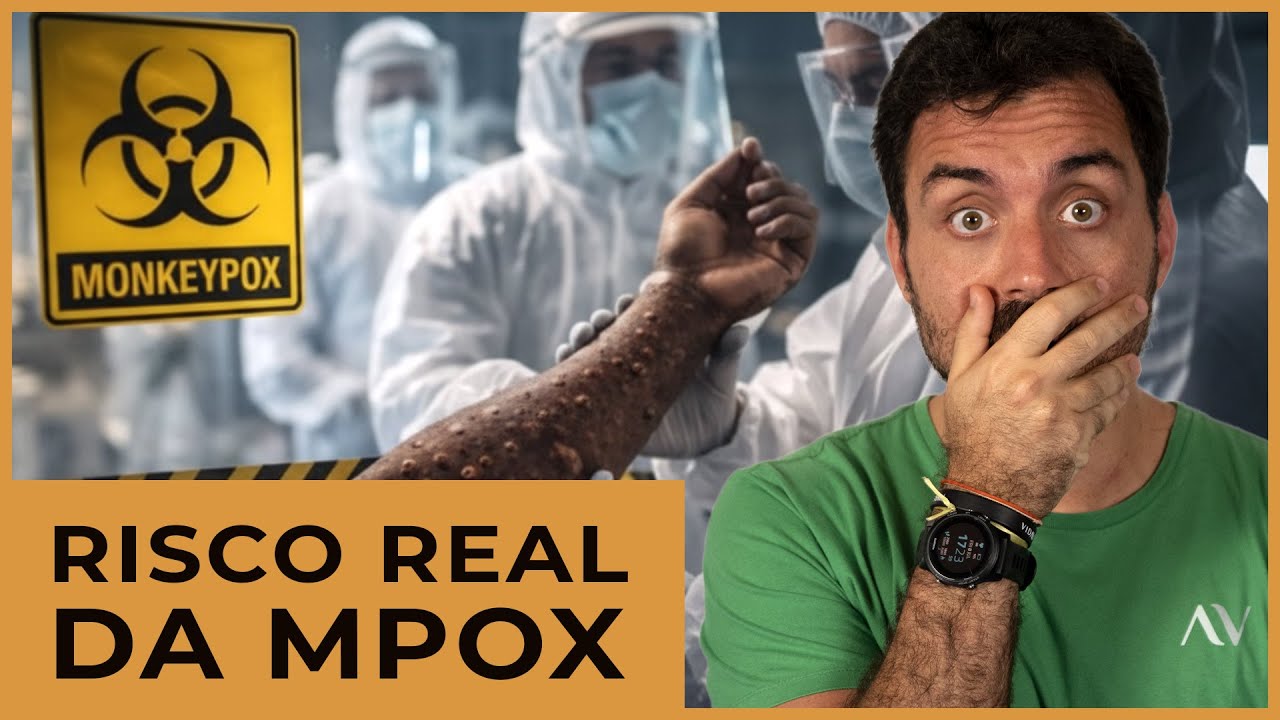 Ayurveda tem tratamento para MPOX?
