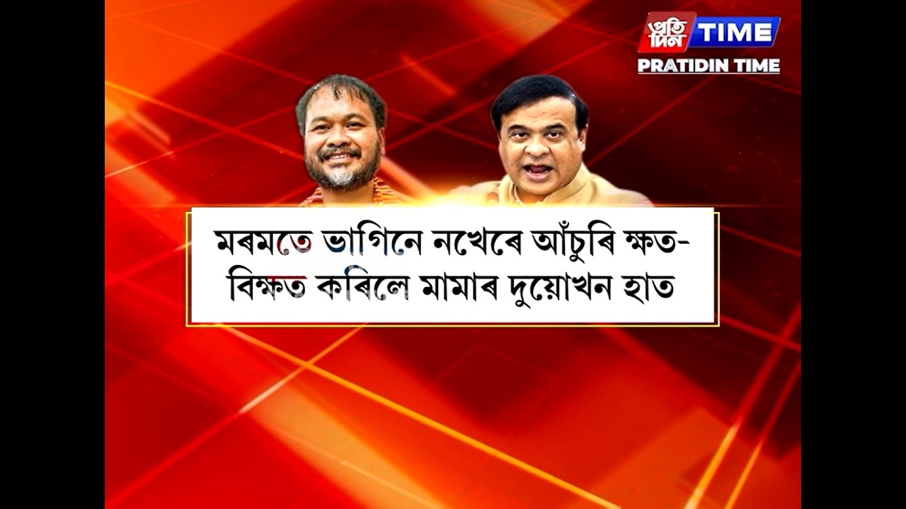 ভাগিনৰ মৰমে নাকটি ছিঙিলে মুখ্যমন্ত্ৰী হিমন্ত বিশ্ব শৰ্মাৰ....
