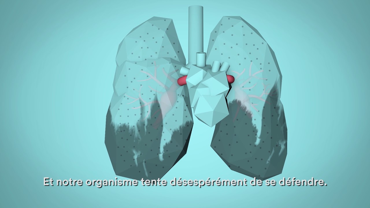 OMS : Respire la vie – la pollution de l’air affecte notre santé