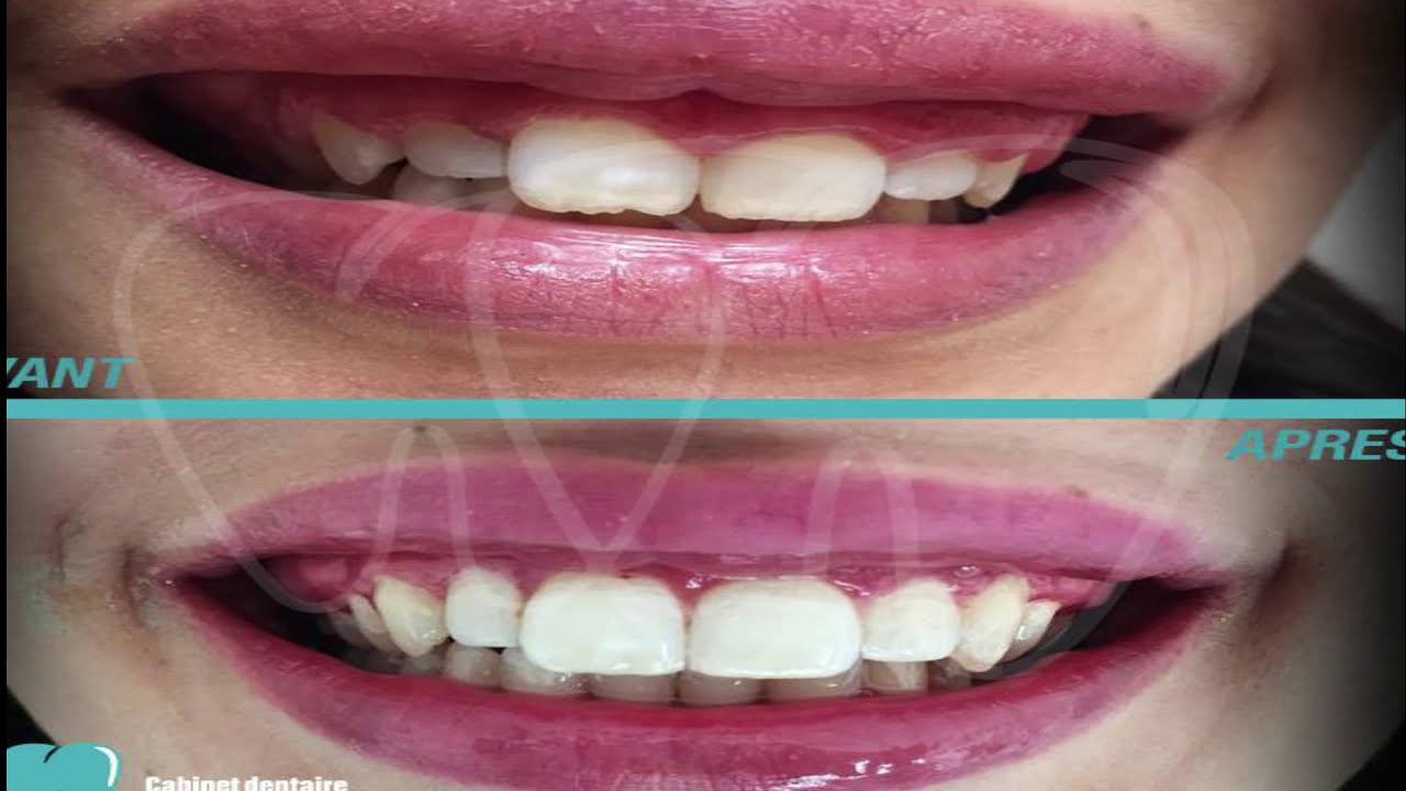 Top 5 des Meilleurs Dentistes A Casablanca