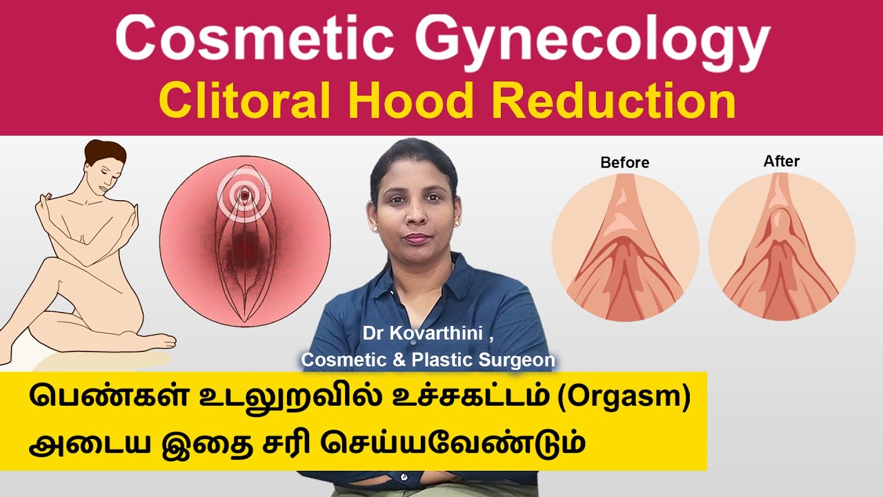 Cosmetic Gynecology |Clitoral Hood Reduction | Dr. Kovarthini Cosmetic & Plastic Surgeon