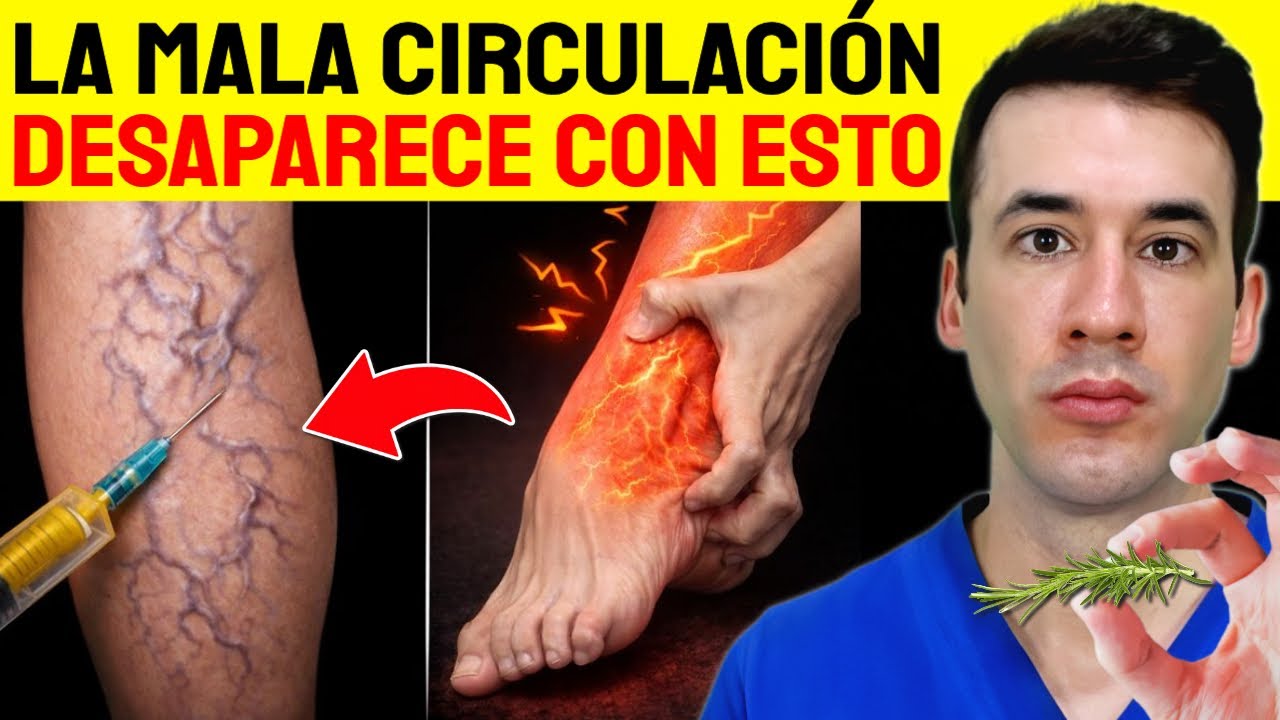 ¡Cura las várices en las piernas con este secreto! - Mejora la circulación