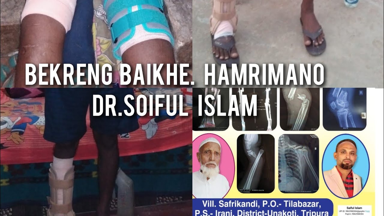 BEKRENG ,BISMA BAIKHE HAMRI OI MANO . TRADITIONAL TREATMENT .DR.SAIFUL ISLAM .