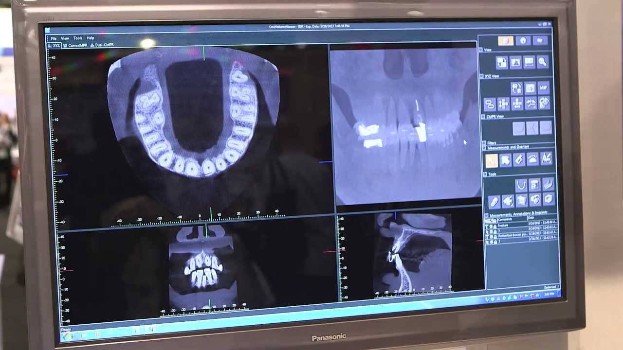 Top Features of the J. Morita Veraviewepocs 3D R100