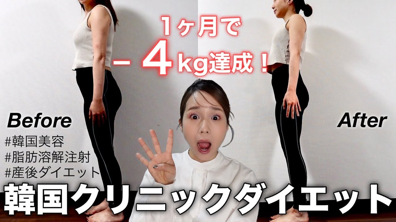 【韓国で話題】脂肪溶解注射とダイエット薬でマイナス4キロ達成！