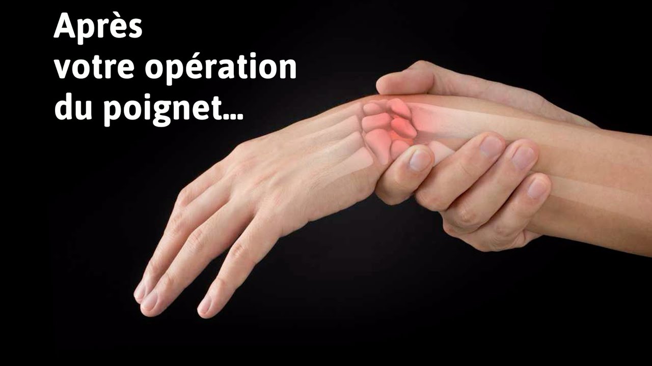 Conseils après votre opération du poignet