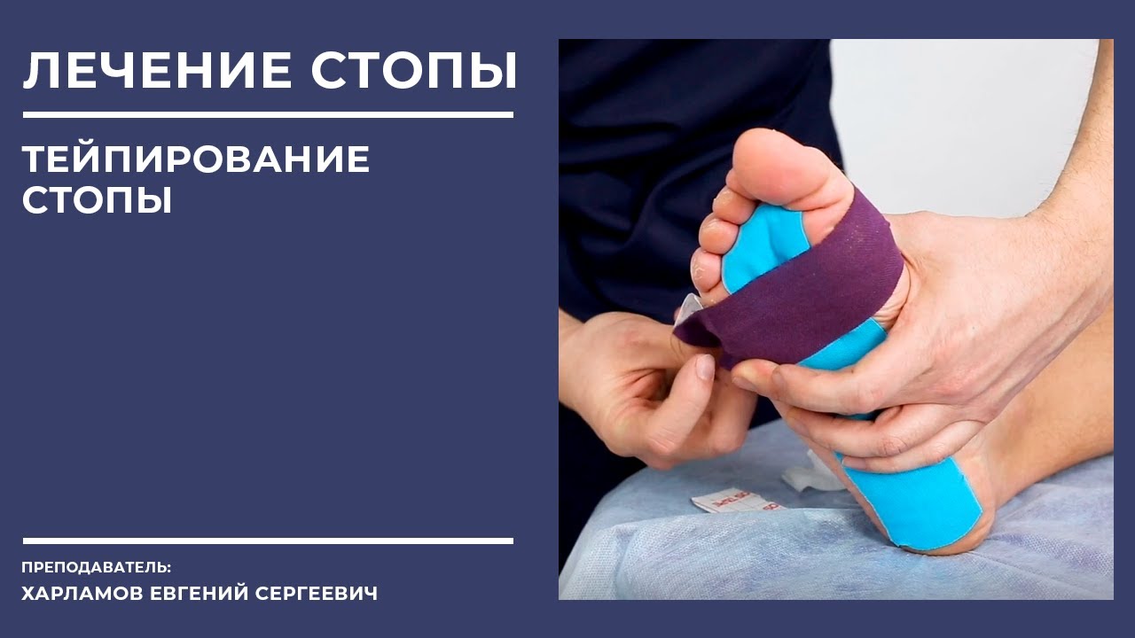 ✅Диагностика стопы. Тейпирование стопы. Изготовление стелек. Ортезирование стопы.