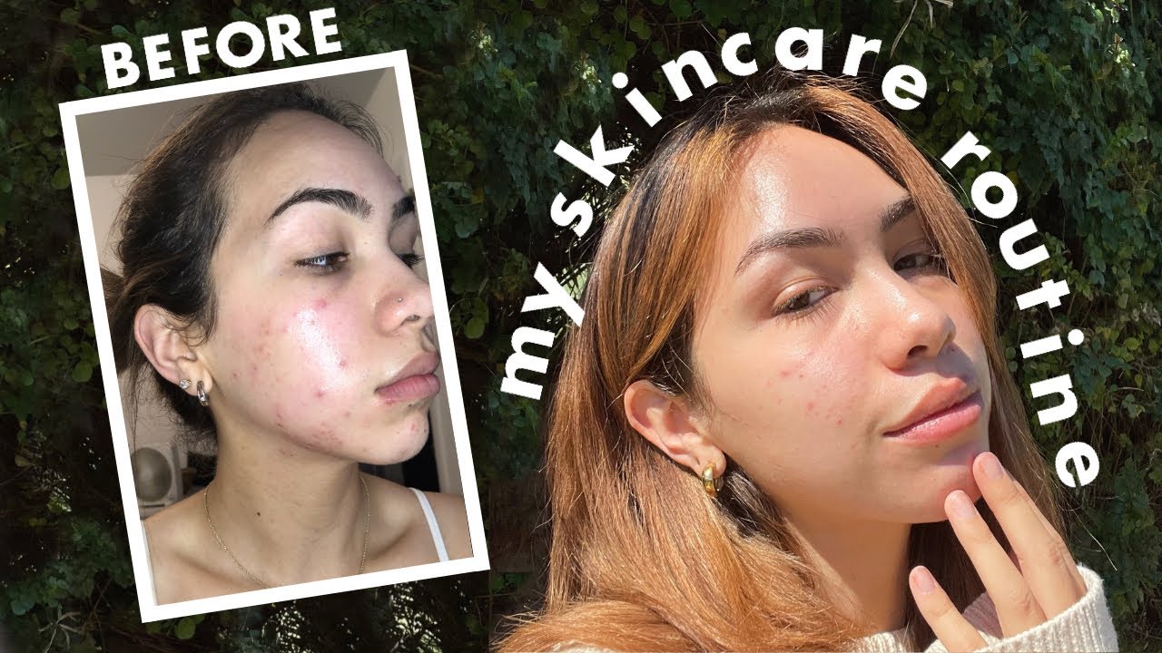 My Night Time & Morning Skincare Routine *How I Cleared My Skin*