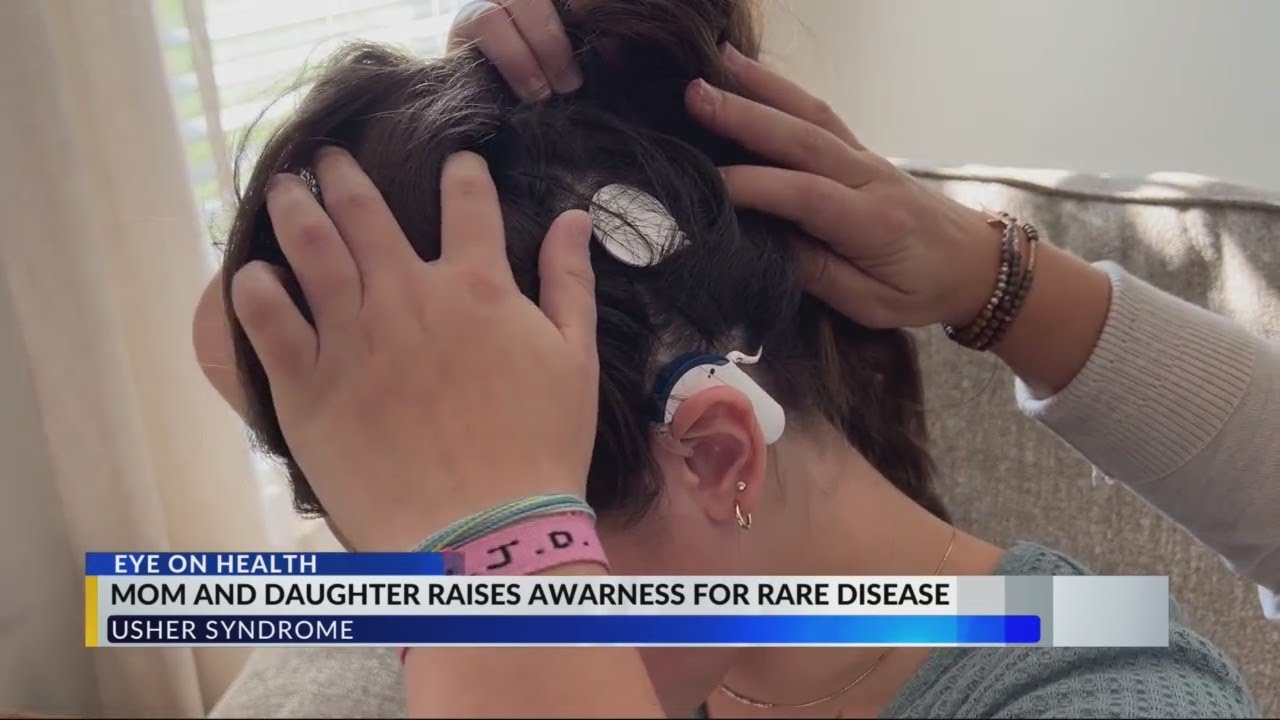 Eye on Health: Usher Disease