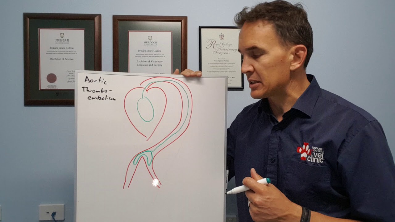 Aortic Thromboembolism