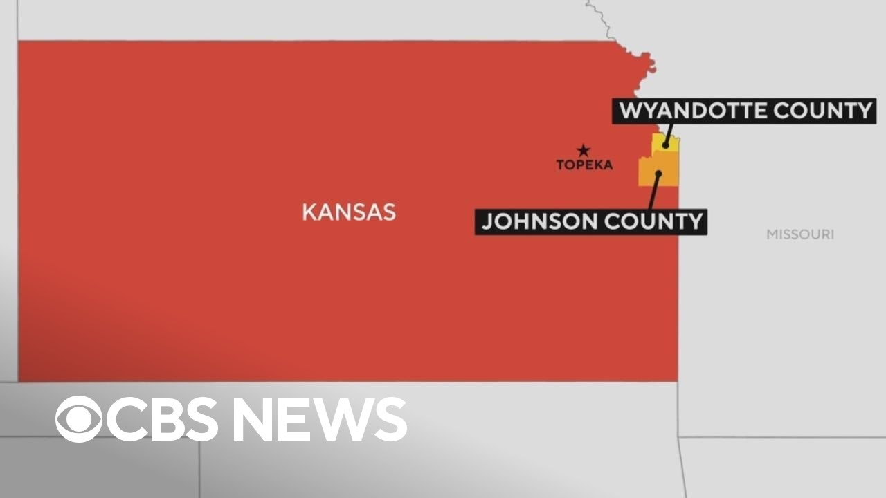 Kansas seeing largest tuberculosis outbreak in U.S. history, dozens of cases reported