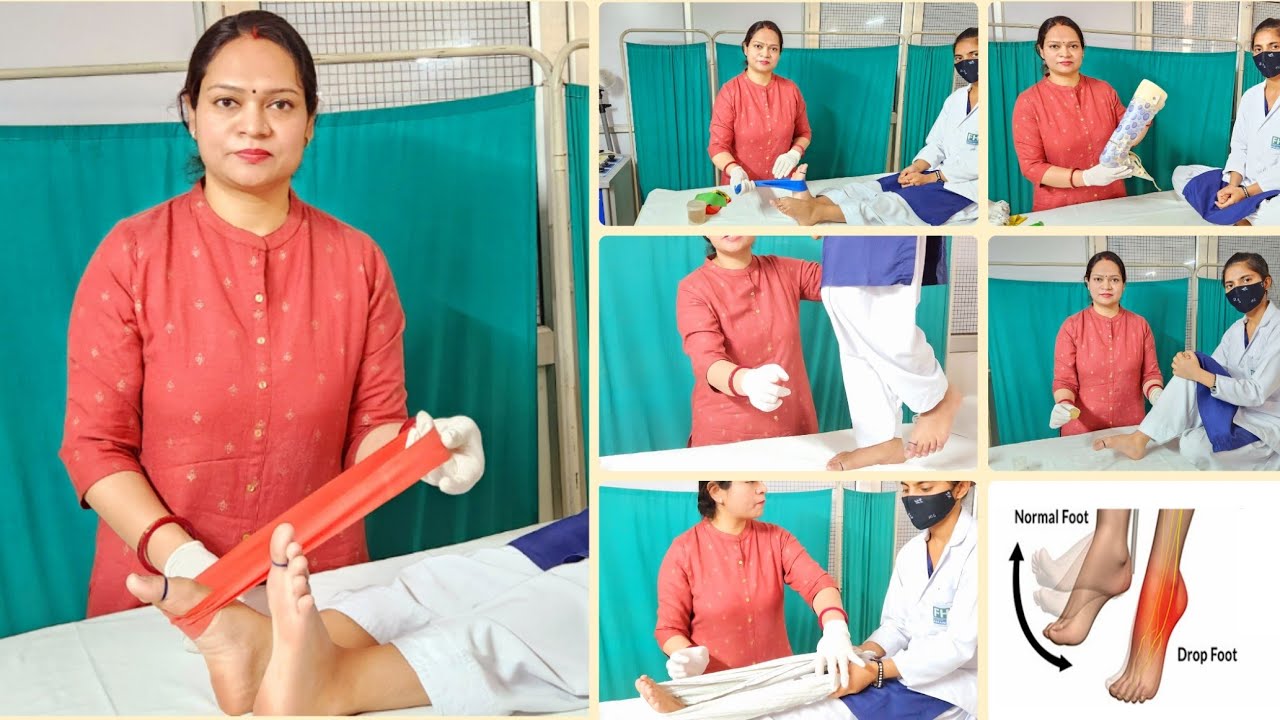 Best physiotherapy Exercises for Foot drop |Dr.Shilpi gupta| बेस्ट  एक्सरसाइज फॉर फुट ड्रॉप#viral