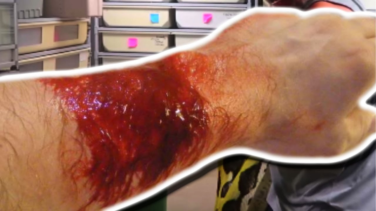 SNAKE BITES!!! CHEWYS BACK!!! | BRIAN BARCZYK