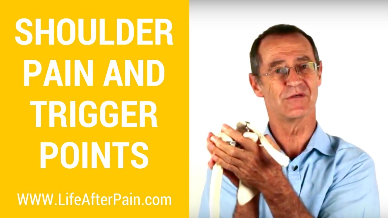 Shoulder Pain and Impingement - Supraspinatus Trigger Points