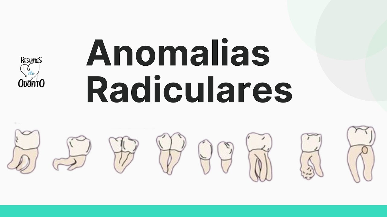 ANOMALIAS RADICULARES | RESUMOS DE ODONTO