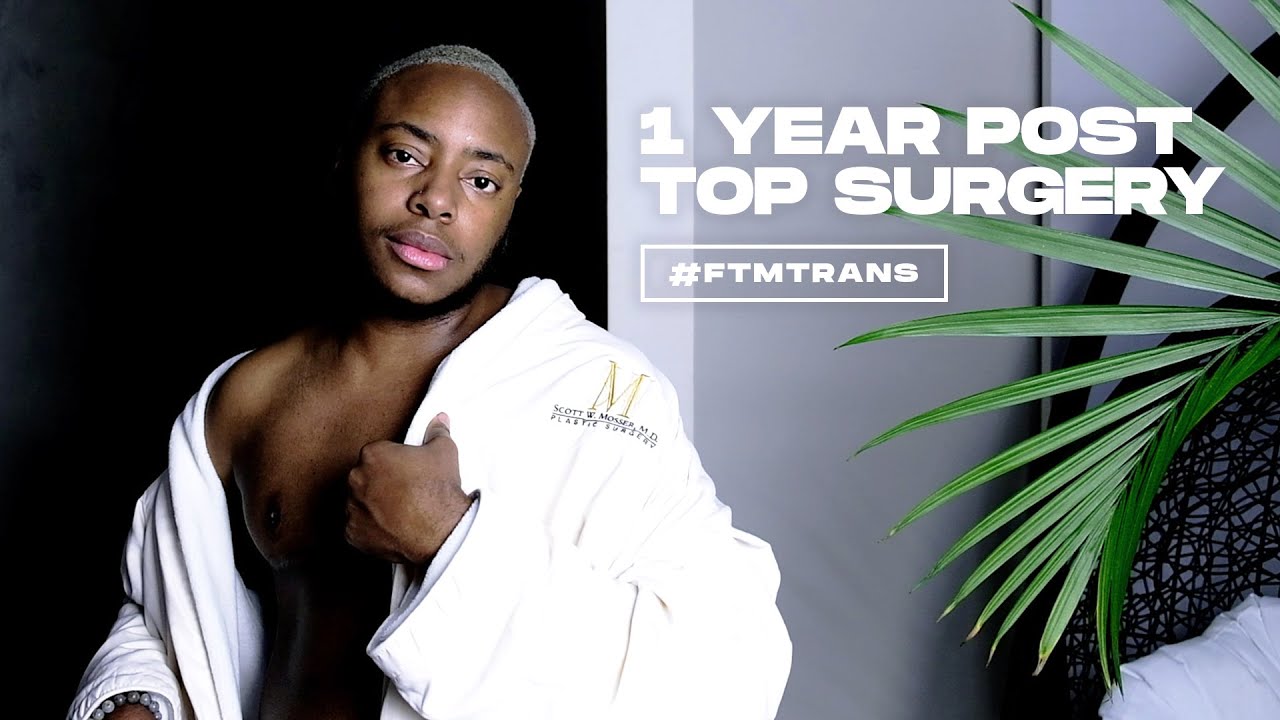 1 Year Post Top Surgery