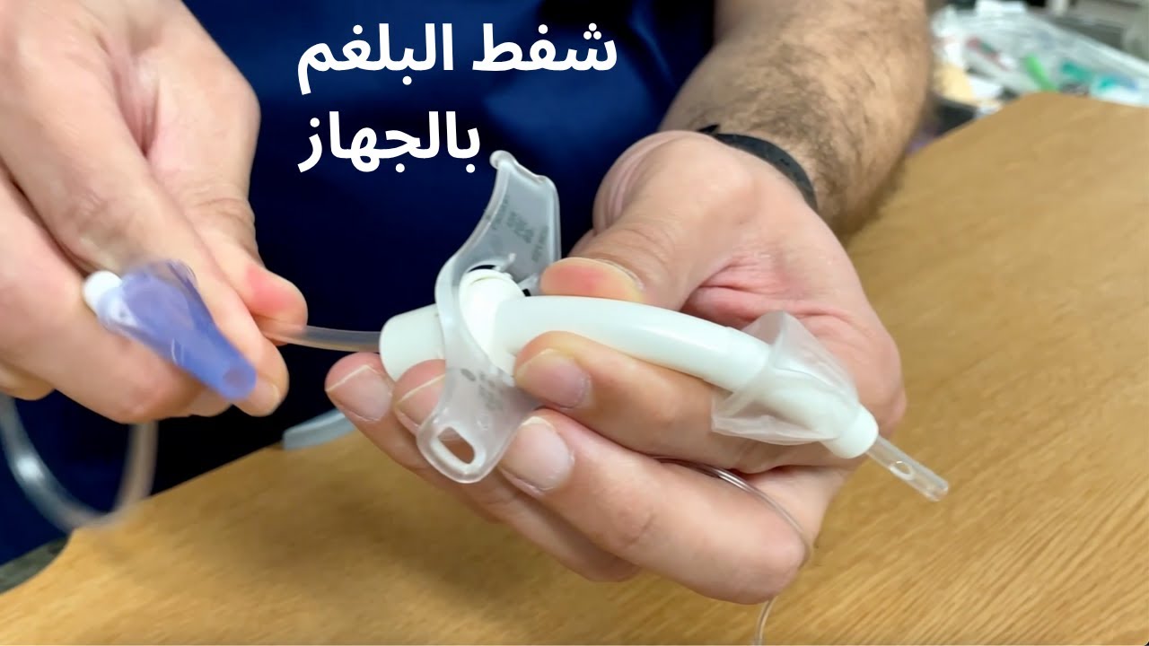 شفط البلغم من أنبوبة الشق الحنجري